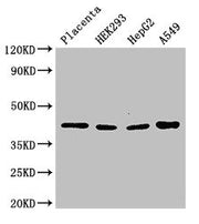 Western Blot Positive WB detected in: Human placenta tissue, HEK293 whole cell lysate, HepG2 whole cell lysate, A549 whole cell lysate All lanes: HSD3B1 antibody at 3µg/ml Secondary Goat polyclonal to rabbit IgG at 1/50000 dilution Predicted band...