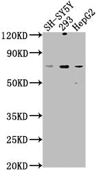 Western Blot Positive WB detected in: SH-SY5Y whole cell lysate, 293 whole cell lysate, HepG2 whole cell lysate All lanes: HSPA12A antibody at 1:1000 Secondary Goat polyclonal to rabbit IgG at 1/50000 dilution Predicted band size: 75 kDa Observed...