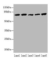 Western blot All lanes: Hspa1b antibody at 5µg/ml Lane 1: A431 whole cell lysate Lane 2: A549 whole cell lysate Lane 3: Jurkat whole cell lysate Lane 4: MCF-7 whole cell lysate Lane 5: K562 whole cell lysate Secondary Goat polyclonal to rabbit IgG...