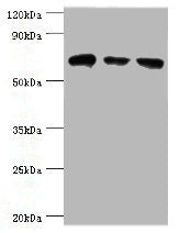 Western blot All lanes: HSPA2 antibody at 6ug/ml Lane 1: A431 whole cell lysate Lane 2: Hela whole cell lysate Lane 3: Rat brain tissue Secondary Goat polyclonal to rabbit IgG at 1/10000 dilution Predicted band size: 70 kDa Observed band size: 70 kDa