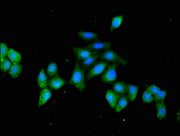 Immunofluorescent analysis of HepG2 cells using CSB-PA010825LA01HU at dilution of 1:100 and Alexa Fluor 488-congugated AffiniPure Goat Anti-Rabbit IgG(H+L)