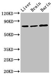 Western Blot Positive WB detected in: Rat liver tissue, Rat brain tissue, Mouse brain tissue All lanes: Hspa5 antibody at 3ug/ml Secondary Goat polyclonal to rabbit IgG at 1/50000 dilution Predicted band size: 73 kDa Observed band size: 73 kDa