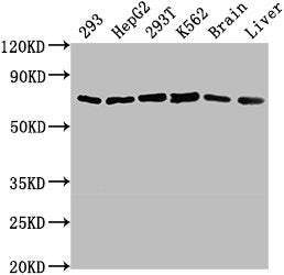 Western Blot Positive WB detected in: 293 whole cell lysate, HepG2 whole cell lysate, 293T whole cell lysate, K562 whole cell lysate, Mouse brain tissue, Mouse liver tissue All lanes: HSPD1 antibody at 1:2000 Secondary Goat polyclonal to rabbit Ig...