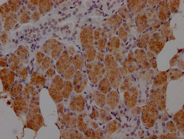 IHC image of CSB-PA010879NA01HU diluted at 1:100 and staining in paraffin-embedded human salivary gland tissue performed on a Leica BondTM system. After dewaxing and hydration, antigen retrieval was mediated by high pressure in a citrate buffer (p...