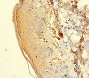 Immunohistochemistry of paraffin-embedded human adrenal gland tissue using CSB-PA010887LA01HU at dilution of 1:100