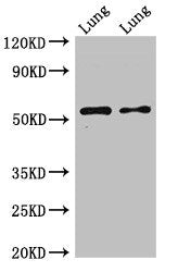 Western Blot Positive WB detected in: Rat lung tissue, Mouse lung tissue All lanes: HTR3A antibody at 2.5ug/ml Secondary Goat polyclonal to rabbit IgG at 1/50000 dilution Predicted band size: 56, 59, 54, 60 kDa Observed band size: 56 kDa