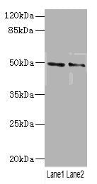 Western blot All lanes: HTR3Bantibody at 3.29ug/ml Lane 1: Mouse lung tissue Lane 2: 293T whole cell lysate Secondary Goat polyclonal to rabbit IgG at 1/10000 dilution Predicted band size: 51, 50 kDa Observed band size: 51 kDa