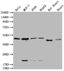Western Blot Positive WB detected in: Hela whole cell lysate, MCF-7 whole cell lysate, A549 whole cell lysate, HepG2 whole cell lysate, Rat Heart tissue, Mouse Heart tissue All lanes: HTR3E antibody at 1:2000 Secondary Goat polyclonal to rabbit Ig...