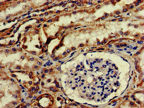 IHC image of CSB-PA010902EA01HU diluted at 1:200 and staining in paraffin-embedded human kidney tissue performed on a Leica BondTM system. After dewaxing and hydration, antigen retrieval was mediated by high pressure in a citrate buffer (pH 6.0)....