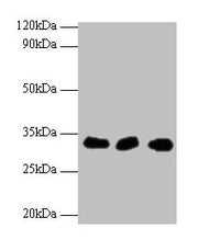 Western blot All lanes: HUS1 antibody at 2µg/ml Lane 1: Hela whole cell lysate Lane 2: 293T whole cell lysate Lane 2: A431 whole cell lysate Secondary Goat polyclonal to rabbit IgG at 1/10000 dilution Predicted band size: 32, 30 kDa Observed band...