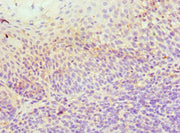Immunohistochemistry of paraffin-embedded human tonsil tissue using CSB-PA010958ESR1HU at dilution of 1:100