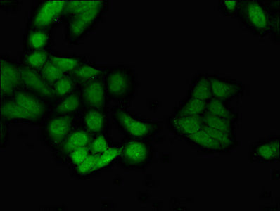 Immunofluorescent analysis of Hela cells using CSB-PA010970LA01HU at dilution of 1:100 and Alexa Fluor 488-congugated AffiniPure Goat Anti-Rabbit IgG(H+L)