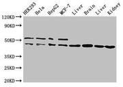 Western Blot Positive WB detected in: HEK293 whole cell lysate, Hela whole cell lysate, HepG2 whole cell lysate, MCF-7 whole cell lysate, Rat liver tissue, Mouse brain tissue, Mouse liver tissue, Mouse kidney tissue All lanes: IDH1 antibody at 2ug...