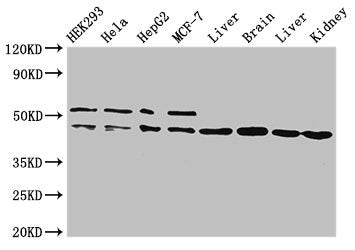 Western Blot Positive WB detected in: HEK293 whole cell lysate, Hela whole cell lysate, HepG2 whole cell lysate, MCF-7 whole cell lysate, Rat liver tissue, Mouse brain tissue, Mouse liver tissue, Mouse kidney tissue All lanes: IDH1 antibody at 2ug...