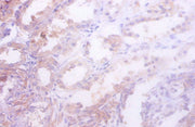 Immunohistochemistry of paraffin-embedded human kidney tissue using CSB-PA010989LA01MO at dilution of 1:50