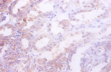 Immunohistochemistry of paraffin-embedded human kidney tissue using CSB-PA010989LA01MO at dilution of 1:50