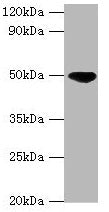 Western blot All lanes: IDH2 antibody at 5µg/ml + Hela whole cell lysate Secondary Goat polyclonal to rabbit IgG at 1/10000 dilution Predicted band size: 51, 46 kDa Observed band size: 51 kDa