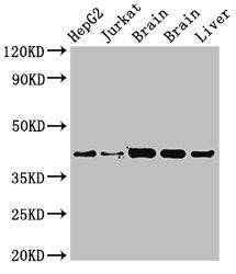 Western Blot Positive WB detected in: HepG2 whole cell lysat, Jurkat whole cell lysate, Rat brain tissue, Mouse brain tissue, Mouse liver tissue All lanes: IDH3A antibody at 3.4µg/ml Secondary Goat polyclonal to rabbit IgG at 1/50000 dilution Pred...