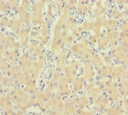 Immunohistochemistry of paraffin-embedded human liver tissue using CSB-PA010997LA01HU at dilution of 1:100