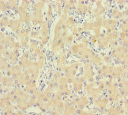 Immunohistochemistry of paraffin-embedded human liver tissue using CSB-PA010997LA01HU at dilution of 1:100