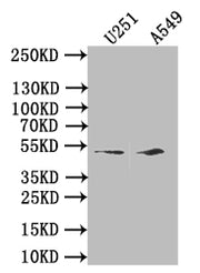 Western Blot Positive WB detected in: HepG2 whole cell lysate, A549 whole cell lysate, NIH/3T3 whole cell lysate All lanes: IFI44L antibody at 2.5µg/ml Secondary Goat polyclonal to rabbit IgG at 1/50000 dilution Predicted band size: 52, 19 kDa Obs...