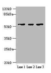 Western blot All lanes: IFIT5 antibody at 2µg/ml Lane 1: A375 whole cell lysate Lane 2: Jurkat whole cell lysate Lane 3: HepG2 whole cell lysate Secondary Goat polyclonal to rabbit IgG at 1/10000 dilution Predicted band size: 56, 51 kDa Observed b...