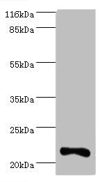 Western blot All lanes: IFNA10 antibody at 2µg/ml + Mouse kidney tissue Secondary Goat polyclonal to rabbit IgG at 1/10000 dilution Predicted band size: 22 kDa Observed band size: 22 kDa