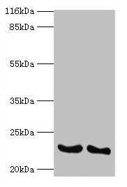 Western blot All lanes: IFNA14 antibody at 2µg/ml Lane 1: A549 whole cell lysate Lane 2: Mouse heart tissue Secondary Goat polyclonal to rabbit IgG at 1/10000 dilution Predicted band size: 23 kDa Observed band size: 23 kDa