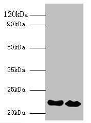 Western blot All lanes: IFNA21 antibody at 2µg/ml Lane 1: NIH/3T3 whole cell lysate Lane 2: HepG2 whole cell lysate Secondary Goat polyclonal to rabbit IgG at 1/10000 dilution Predicted band size: 22 kDa Observed band size: 22 kDa
