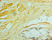 Immunohistochemistry of paraffin-embedded human weasand tissue using CSB-PA011040ESR1HU at dilution of 1:100