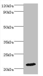 Western blot All lanes: IFNA4 antibody at 2µg/ml + Mouse kidney tissue Secondary Goat polyclonal to rabbit IgG at 1/10000 dilution Predicted band size: 22 kDa Observed band size: 22 kDa