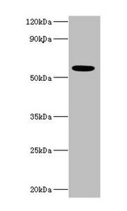 Western blot All lanes: IFNAR2 antibody at 10µg/ml + MCF-7 whole cell lysate Secondary Goat polyclonal to rabbit IgG at 1/10000 dilution Predicted band size: 58, 38, 28 kDa Observed band size: 58 kDa