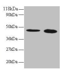 Western blot All lanes: TTC1 antibody at 2µg/ml Lane 1: 293T whole cell lysate Lane 2: EC109 whole cell lysate Secondary Goat polyclonal to rabbit IgG at 1/15000 dilution Predicted band size: 34 kDa Observed band size: 45 kDa
