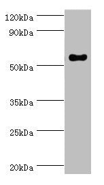 Western blot All lanes: IFNGR1 antibody at 2ug/ml + Mouse lung tissue Secondary Goat polyclonal to rabbit IgG at 1/10000 dilution Predicted band size: 55, 22 kDa Observed band size: 55 kDa