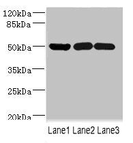 Western blot All lanes: IFRD1 antibody at 1.76ug/ml Lane 1: Mouse skeletal muscle tissue Lane 2: Hela whole cell lysate Lane 3: Jurkat whole cell lysate Secondary Goat polyclonal to rabbit IgG at 1/10000 dilution Predicted band size: 51, 46 kDa Ob...