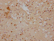 IHC image of CSB-PA011069LA01HU diluted at 1:500 and staining in paraffin-embedded human brain tissue performed on a Leica BondTM system. After dewaxing and hydration, antigen retrieval was mediated by high pressure in a citrate buffer (pH 6.0). S...
