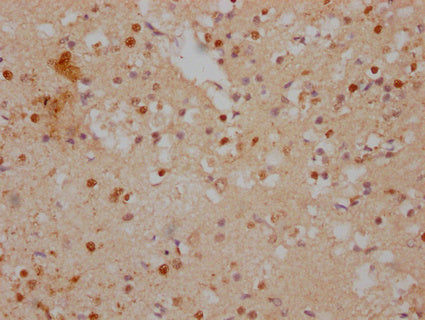 IHC image of CSB-PA011069LA01HU diluted at 1:500 and staining in paraffin-embedded human brain tissue performed on a Leica BondTM system. After dewaxing and hydration, antigen retrieval was mediated by high pressure in a citrate buffer (pH 6.0). S...