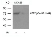 Western blot analysis of extracts from MDA231 cells untreated or treated with UV using ATF2(Phospho-Ser62 or 44) Antibody.
