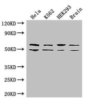 Western Blot Positive WB detected in: Hela whole cell lysate, K562 whole cell lysate, HEK293 whole cell lysate, Mouse brain tissue All lanes: IGF2BP3 antibody at 2ug/ml Secondary Goat polyclonal to rabbit IgG at 1/50000 dilution Predicted band siz...