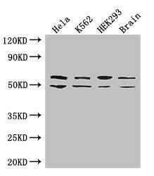 Western Blot Positive WB detected in: Hela whole cell lysate, K562 whole cell lysate, HEK293 whole cell lysate, Mouse brain tissue All lanes: IGF2BP3 antibody at 2ug/ml Secondary Goat polyclonal to rabbit IgG at 1/50000 dilution Predicted band siz...