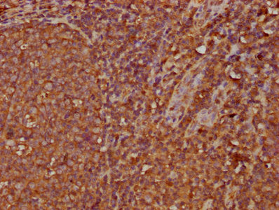 IHC image of CSB-PA011112LA01HU diluted at 1:300 and staining in paraffin-embedded human tonsil tissue performed on a Leica BondTM system. After dewaxing and hydration, antigen retrieval was mediated by high pressure in a citrate buffer (pH 6.0)....