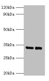 Western blot All lanes: SRM antibody at 2µg/ml Lane 1: EC109 whole cell lysate Lane 2: 293T whole cell lysate Secondary Goat polyclonal to rabbit IgG at 1/15000 dilution Predicted band size: 34 kDa Observed band size: 34 kDa