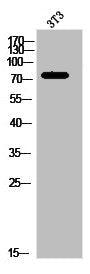 Western Blot analysis of 3T3 cells using IRAK-1 Polyclonal Antibody
