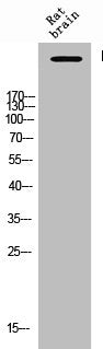 Western Blot analysis of Rat-brain cells using Phospho-IP3R-I (S1764) Polyclonal Antibody