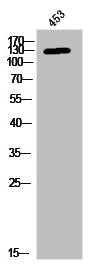 Western Blot analysis of 453 cells using Phospho-JAK3 (Y785) Polyclonal Antibody
