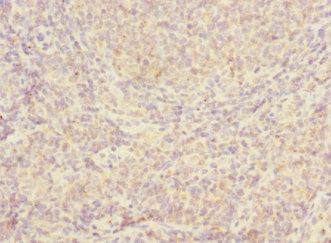 Immunohistochemistry of paraffin-embedded human tonsil tissue using CSB-PA011337DSR1HU at dilution of 1:100
