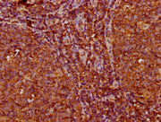 IHC image of CSB-PA011340LA01HU diluted at 1:200 and staining in paraffin-embedded human tonsil tissue performed on a Leica BondTM system. After dewaxing and hydration, antigen retrieval was mediated by high pressure in a citrate buffer (pH 6.0)....