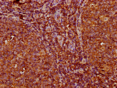 IHC image of CSB-PA011340LA01HU diluted at 1:200 and staining in paraffin-embedded human tonsil tissue performed on a Leica BondTM system. After dewaxing and hydration, antigen retrieval was mediated by high pressure in a citrate buffer (pH 6.0)....