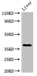 Western Blot Positive WB detected in: Rat liver tissue All lanes: PRKAG1 antibody at 3ug/ml Secondary Goat polyclonal to rabbit IgG at 1/50000 dilution Predicted band size: 38, 35, 39 kDa Observed band size: 38 kDa