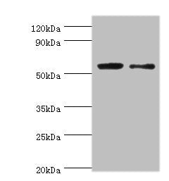 Western blot All lanes: PGD antibody at 2µg/ml Lane 1: EC109 whole cell lysate Lane 2: 293T whole cell lysate Secondary Goat polyclonal to rabbit IgG at 1/15000 dilution Predicted band size: 54, 52 kDa Observed band size: 54 kDa